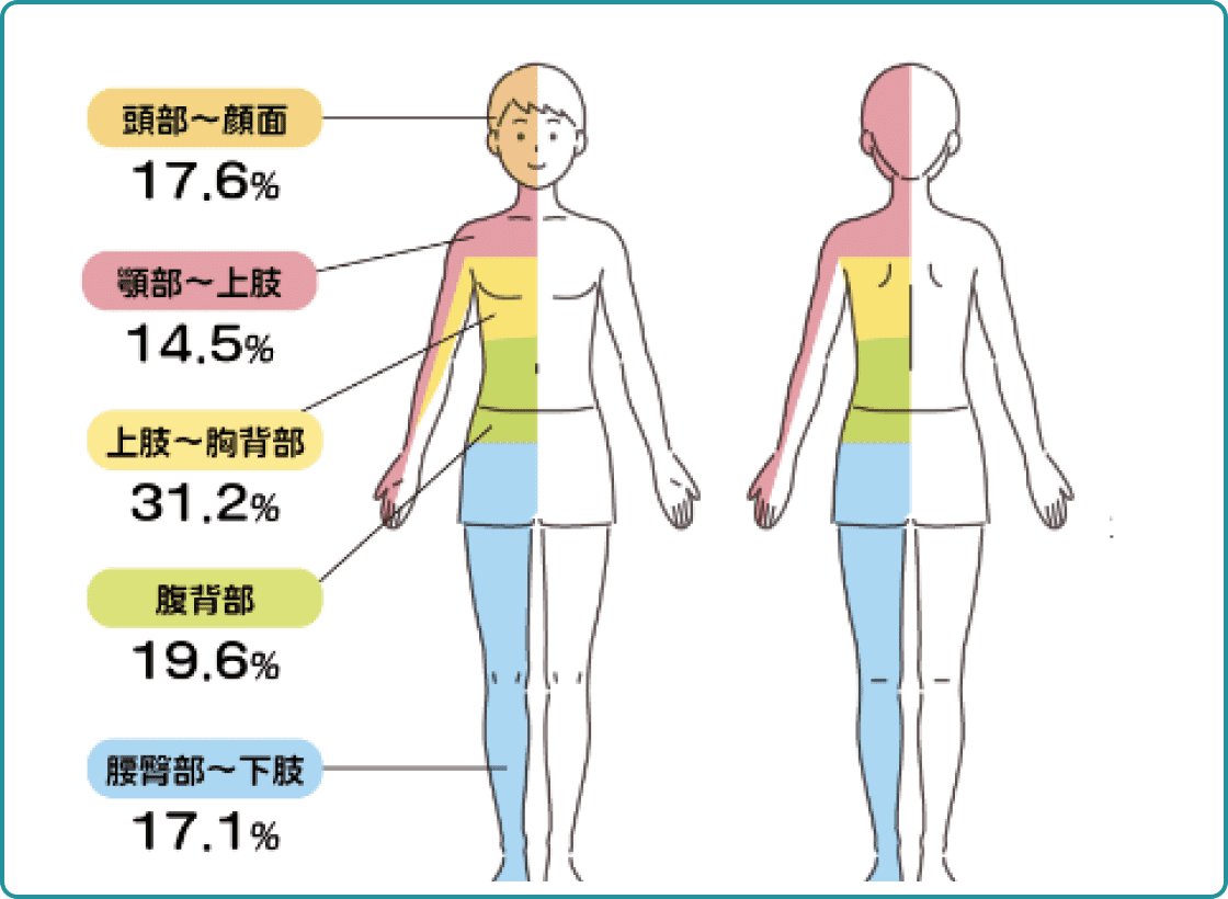 帯状疱疹の症状