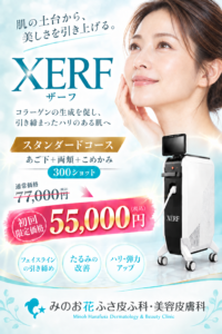 XERF（ザーフ）初回限定キャンペーン